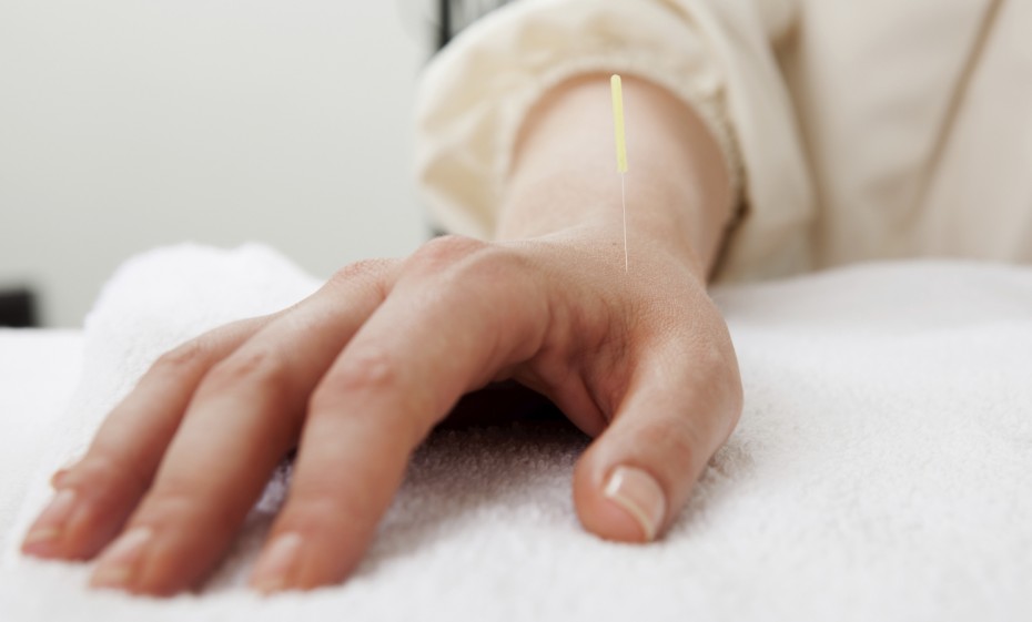 Meridian Acupuncture for Portland area patients.
