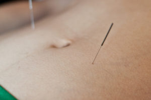 Acupuncture in Portland offered - can help with insomnia.