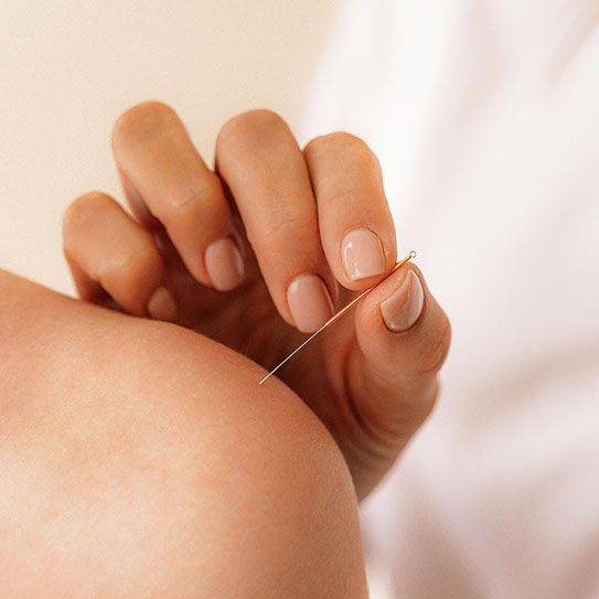 reasons to see an acupuncturist acupuncture